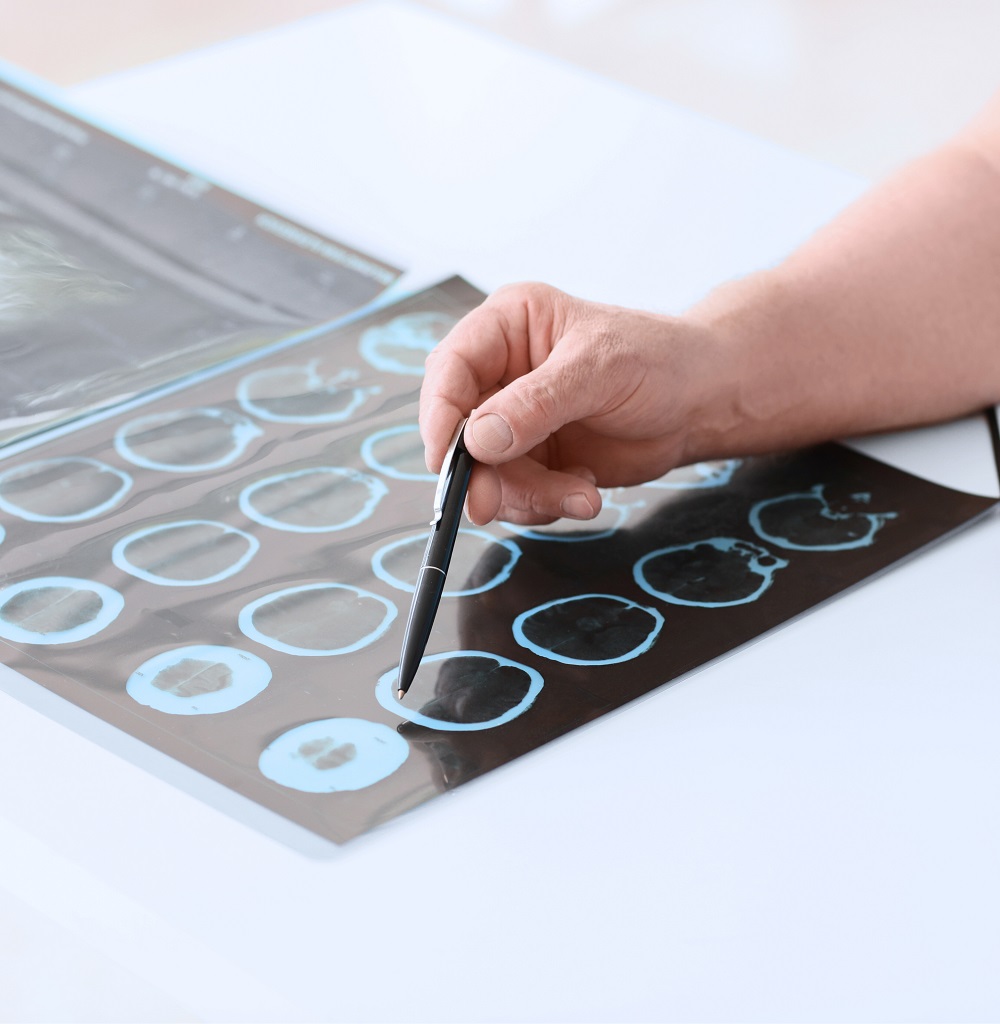 Невролог в Одесі - неврологія Одеса