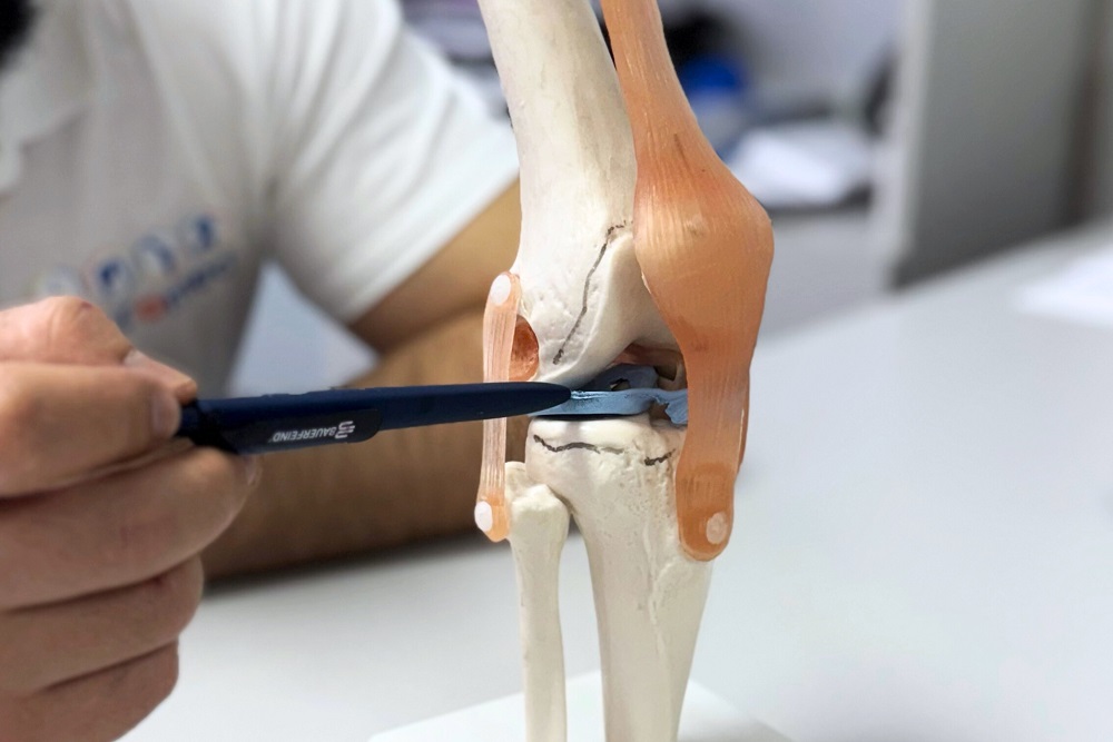 розрив меніска - травматолог Одеса